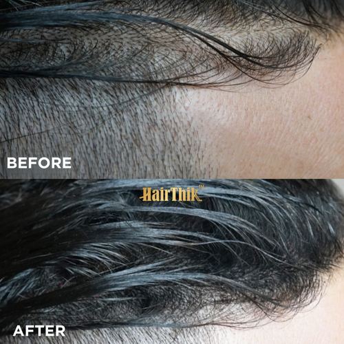 HairThik Hair Fibers Kit, view 8